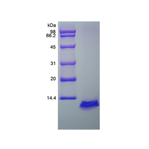 重组人活化调控正常T细胞表达序列/CCL5
