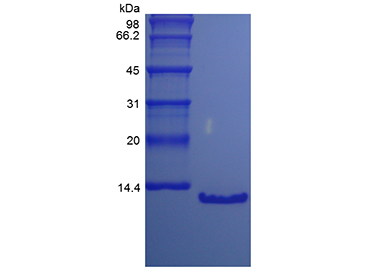 重组人PTH7-84,15N,Recombinant Human Parathyroid Hormone 7-84, 15N Stable Isotope Labeled