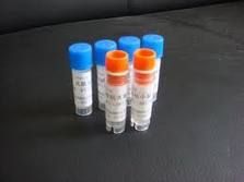 兔抗DIABLO多克隆抗体,Anti-DIABLO rabbit polyclonal antibody