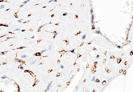 兔抗CD38多克隆抗体,Anti-CD38 rabbit polyclonal antibody