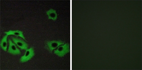 兔抗BAX多克隆抗体,Anti-BAX rabbit polyclonal antibody