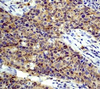 CASPASE-3抗體,Caspase-3 antibody