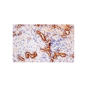 AMPK ALPHA 1 RABBIT MONOCLONAL ANTIBODY,AMPK alpha 1 Rabbit Monoclonal Antibody