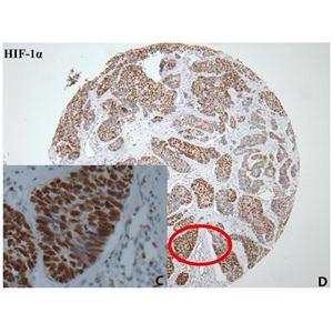 HIF-1Α抗体(小鼠单抗)