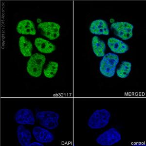 HDAC2鼠单克隆抗体,Anti-Histone Deacetylase 2 (HDAC2) antibody, Mouse monoclonal
