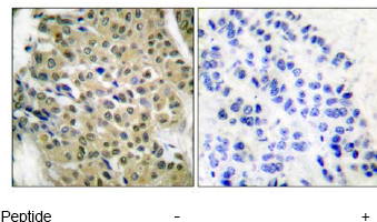 HDAC5鼠單克隆抗體,Anti-Histone Deacetylase 5 (HDAC5) antibody, Mouse monoclonal