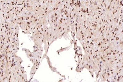 兔抗MGMT多克隆抗體,Anti-MGMT rabbit polyclonal antibody