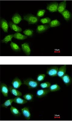 PRMT5 鼠單克隆抗體,PRMT5 Mouse Monoclonal Antibody