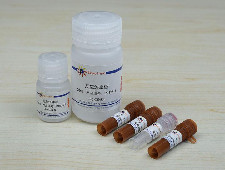 抗氟离子酸性磷酸酶检测试剂盒,抗氟离子酸性磷酸酶检测试剂盒