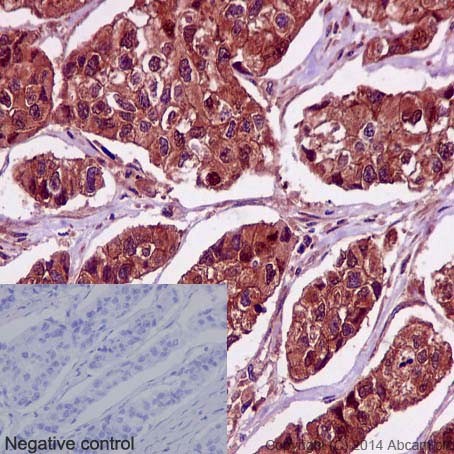 兔抗PRMT5多克隆抗体,Anti-PRMT5 rabbit polyclonal antibody