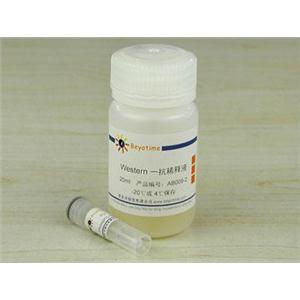 Phospho-Bad(Ser112)抗体(小鼠单抗)