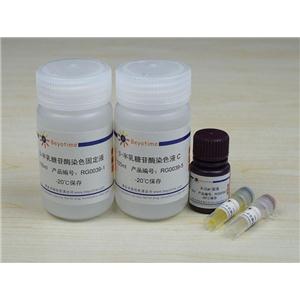 β-半乳糖苷酶原位染色试剂盒,β-半乳糖苷酶原位染色试剂盒