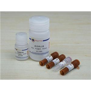 抗氟离子酸性磷酸酶检测试剂盒