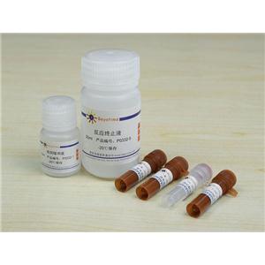 抗酒石酸酸性磷酸酶检测试剂盒