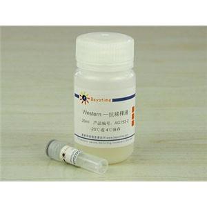Phospho-GSK-3β(Ser9)抗体(兔多抗)