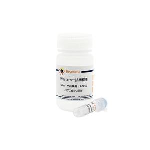 NGF Rabbit Monoclonal Antibody,NGF Rabbit Monoclonal Antibody