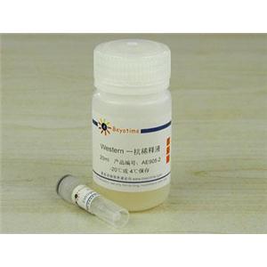 Estrogen Receptor α抗体(兔单抗)