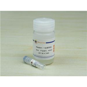 Caveolin-1 Mouse Monoclonal Antibody,Caveolin-1 Mouse Monoclonal Antibody