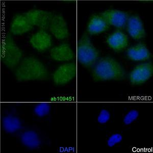 兔抗PRMT5多克隆抗体,Anti-PRMT5 rabbit polyclonal antibody