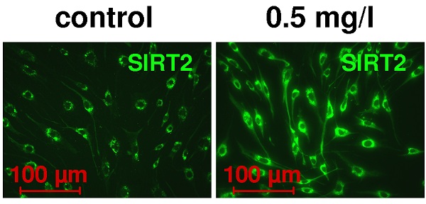SIRT2 兔单克隆抗体,SIRT2 Rabbit Monoclonal Antibody