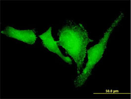 VASP 兔单克隆抗体,VASP Rabbit Monoclonal Antibody