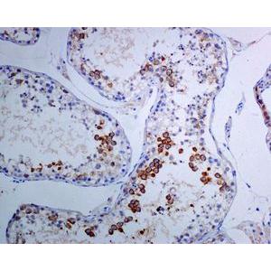 TACC3 兔单克隆抗体,TACC3 Rabbit Monoclonal Antibody