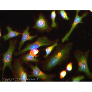 兔抗S100A4多克隆抗体,Anti-S100A4 rabbit polyclonal antibody