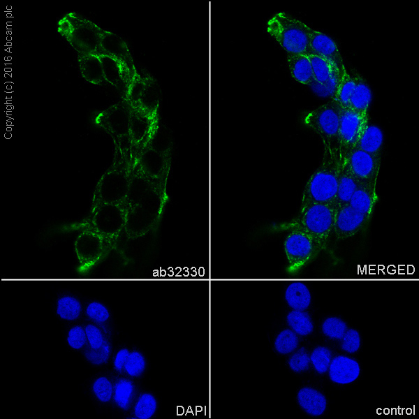 CALDESMON 兔单克隆抗体,Caldesmon Rabbit Monoclonal Antibody