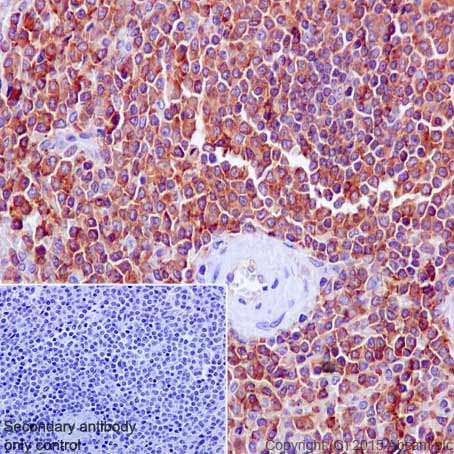 MOESIN 兔单克隆抗体,Moesin Rabbit Monoclonal Antibody