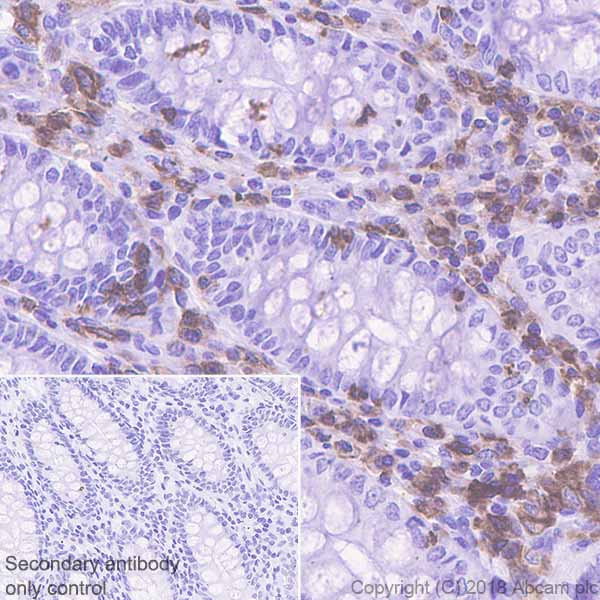 LSP1 兔单克隆抗体,LSP1 Rabbit Monoclonal Antibody