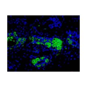 EPCAM 小鼠单克隆抗体,EPCAM Mouse Monoclonal Antibody