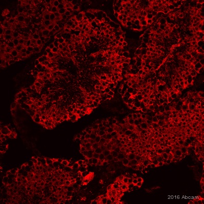 β微管蛋白兔单克隆抗体,beta Tubulin Rabbit Monoclonal Antibody