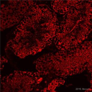 β微管蛋白兔单克隆抗体,beta Tubulin Rabbit Monoclonal Antibody