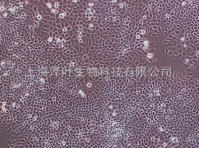 INS-1(大鼠胰岛细胞瘤细胞)