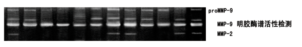 明膠酶譜MMP(2/9)
