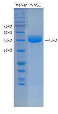 重组人神经元特异性烯醇化酶/γ 烯醇化酶 蛋白质,Recombinant human NSE Protein