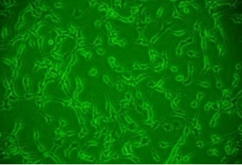 COS-7/非洲绿猴SV40转化的肾细胞