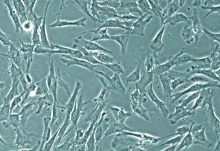 小鼠原代食管成纤维细胞