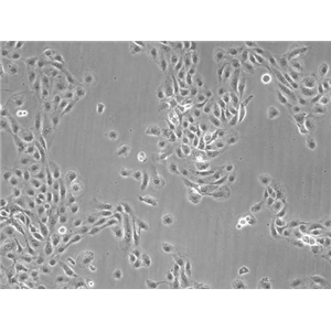 小鼠原代肝星状细胞