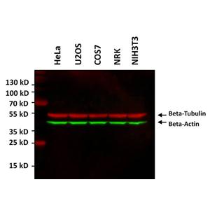 beta Actin Monoclonal Antibody (15G5A11/E2)