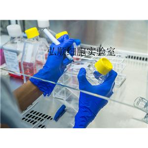 SU-DHL-2细胞：人弥漫性大细胞淋巴瘤细胞