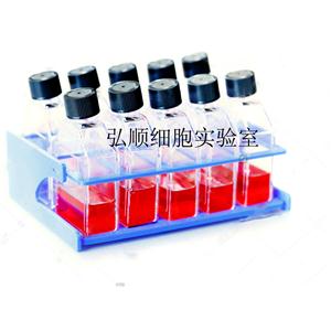 SNU119细胞：人卵巢癌细胞,SNU119 Cell