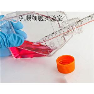 HPaSteC(HPSC)细胞：人胰腺星状细胞