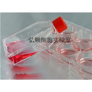 Co-115细胞：人结肠腺癌细胞,Co-115 Cell