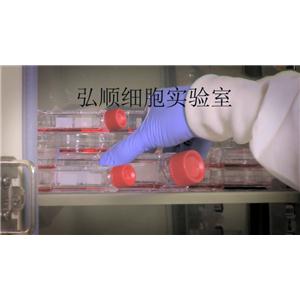 HCC1008细胞：人乳腺导管癌细胞,HCC1008 Cell