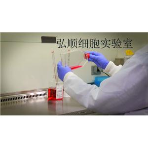 HepG-2细胞：人肝癌细胞,HepG-2 Cell