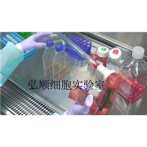 HCT-8(HRT-18)细胞：人结直肠腺癌细胞,HCT-8(HRT-18) Cell