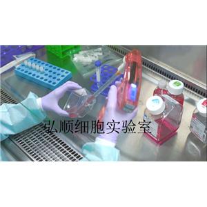 NCI-H82[H82]细胞：人肺癌细胞