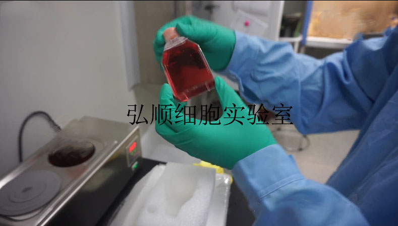 NCM460细胞：结直肠腺癌细胞,NCM460 Cell