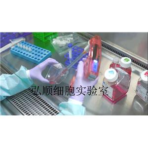 COR-L279细胞：人肺小细胞癌细胞,COR-L279 Cell